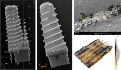 ksem, eds, impianti dentali