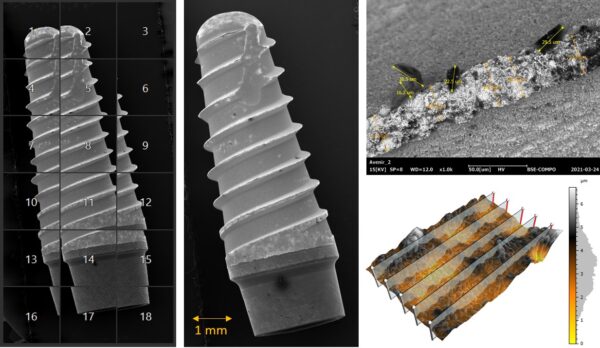 ksem, eds, impianti dentali