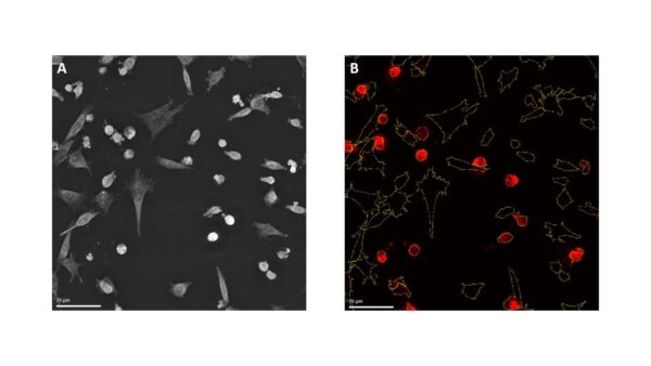 Analisi cellulare con il nuovo modulo LCA di Nanolive, che integra imaging label-free e fluorescenza per esperimenti avanzati.