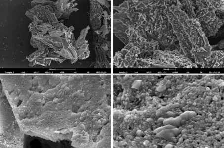 SEM, drug delivery, vescicole, microscopia, microscopia elettronica