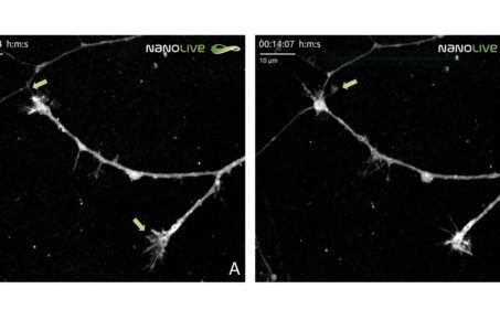 Nanolive, live-cell imaging, label-free, olotomografia, microscopia, biologia, tomocube, neuroscienza