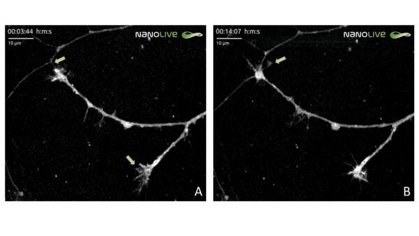 Nanolive, live-cell imaging, label-free, olotomografia, microscopia, biologia, tomocube, neuroscienza