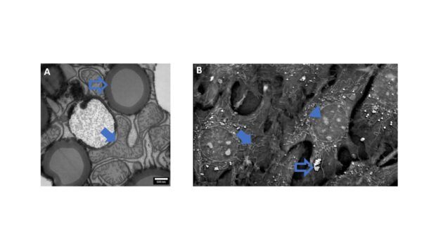 metabolismo cellulare, biologia, nanolive, flim labs, femtonics