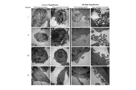 microscopio elettronico a trasmissione, microscopia elettronica, tem , stem, preparativa dei campioni