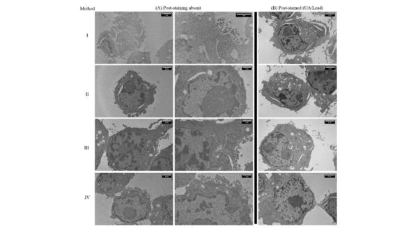 preparativa dei campioni, microscopia elettronica, microscopio elettronico a trasmissione, tem, sputter, sem, stem