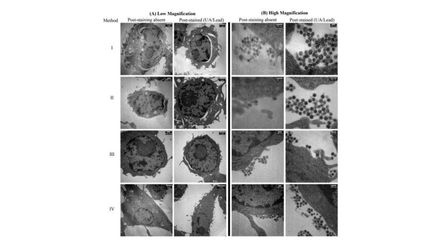 microscopio elettronico a trasmissione, microscopia elettronica, tem , stem, preparativa dei campioni