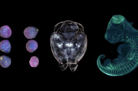lightsheet, biologia, organoidi