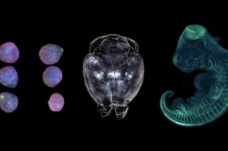 lightsheet, biologia, organoidi