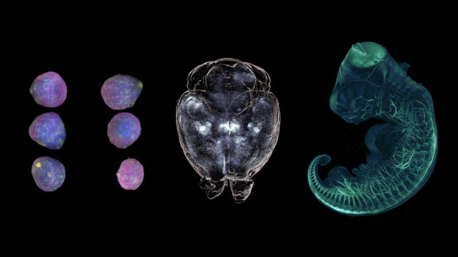 lightsheet, biologia, organoidi