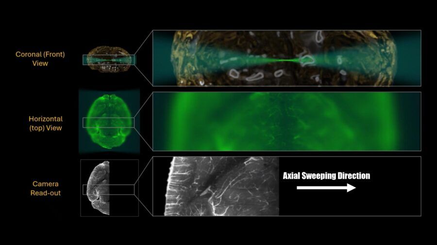 lightsheet, biologia, smartbatch, life canvas, tessuti, organoidi