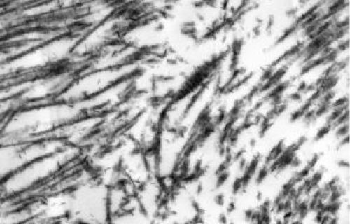 HEM 6000, Volume Electron Microscopy, VEM