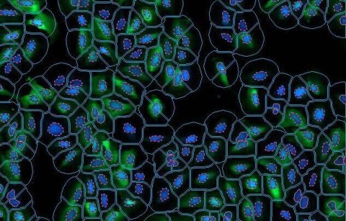 media cybernetics, mediacy, immagini, elaborazione di immagini, scienze dei materiali, scienze della vita, microscopia, imaging, AI, IA, Intelligenza artificiale, Machine learning