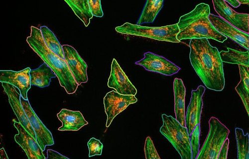 media cybernetics, mediacy, immagini, elaborazione di immagini, scienze dei materiali, scienze della vita, microscopia, imaging, AI, IA, Intelligenza artificiale, Machine learning